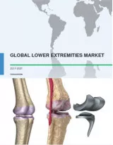 Global Lower Extremities Market 2017-2021