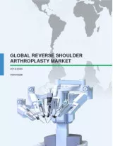 Global Reverse Shoulder Arthroplasty Market 2016-2020