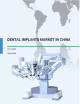 Dental Implants Market in China 2016-2020