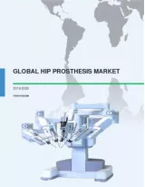 Global Hip Prosthesis Market 2016-2020