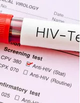 HIV-AIDS Testing Market by End-users and Geography - Forecast and Analysis 2019-2023