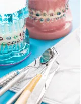 Orthodontic Supplies Market by Type and Geography - Forecast and Analysis 2022-2026