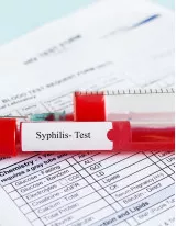 Syphilis Testing Market by Technology and Geography - Forecast and Analysis 2020-2024