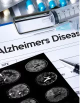 Alzheimers Disease Therapeutics Market by Drug Class, Distribution Channel, and Geography - Forecast and Analysis 2023-2027