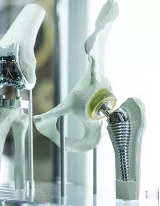 Orthopedic Implants Market by Product and Geography - Forecast and Analysis 2022-2026