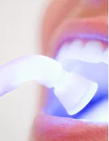 Teeth Whitening Market by Product and Geography - Forecast and Analysis 2020-2024