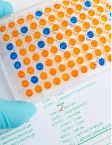 Enzyme-linked Immunosorbent Assay (Elisa) Market by End-user and Geography - Forecast and Analysis 2021-2025
