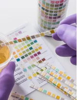 Urinalysis Market by End-user, Product and Geography - Forecast and Analysis 2022-2026