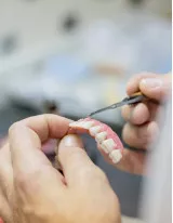 Global Dental Restoration Market by Product and Geography - Forecast and Analysis 2021-2025